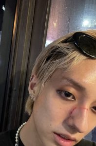 HOLLAND shares he was the victim of a homophobic hate crime last night