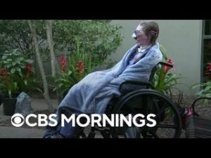 Girl gets visciously attacked by dogs, cops wait 37 minutes while she lies in pain
