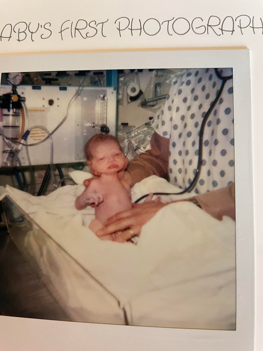 The NICU nurses called me E.T., as did my mother…