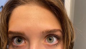 Had my eyes dilated earlier…only one of my pupils returned to normal size