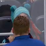 Young Woman spots cancerous mole on this coach's neck in the middle of this hockey game