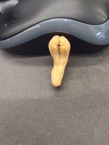 This cashew needs to calm down.