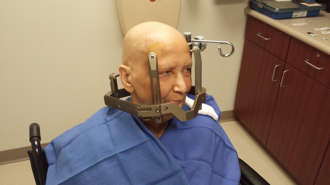 My mother prepping for Gamma Knife radiation procedure 2014 for a brain tumor.