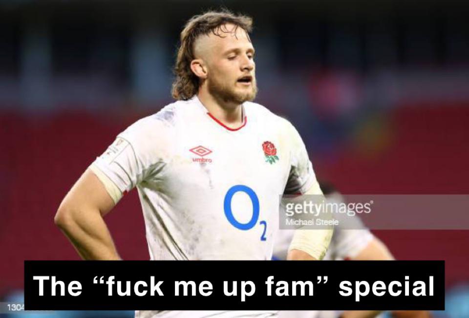 In your opinion, who has the worst lid in rugby?