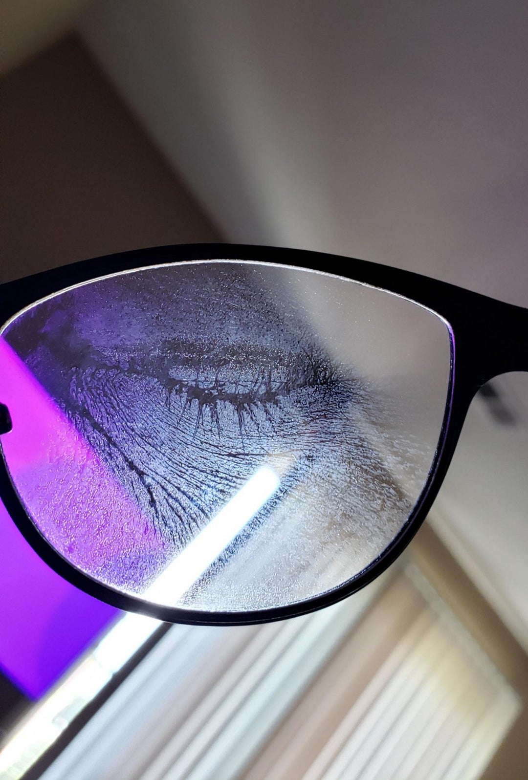 The imprint of an eye after glasses got smushed against face