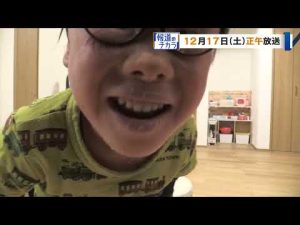 『ＣＢＣスペシャル 報道のチカラ ～地域の声をつなぐ～』ピエロと呼ばれた息子～道化師様魚鱗癬との闘い～ 4時間の生放送でお届けします。