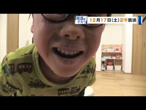 『ＣＢＣスペシャル 報道のチカラ ～地域の声をつなぐ～』ピエロと呼ばれた息子～道化師様魚鱗癬との闘い～ 4時間の生放送でお届けします。